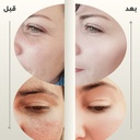 The Ordinary Aha 30% + Bha 2% Peeling Solution 30ml