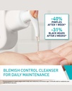 CERAVE ANTI BLEMISH CONTROL CLEANSER