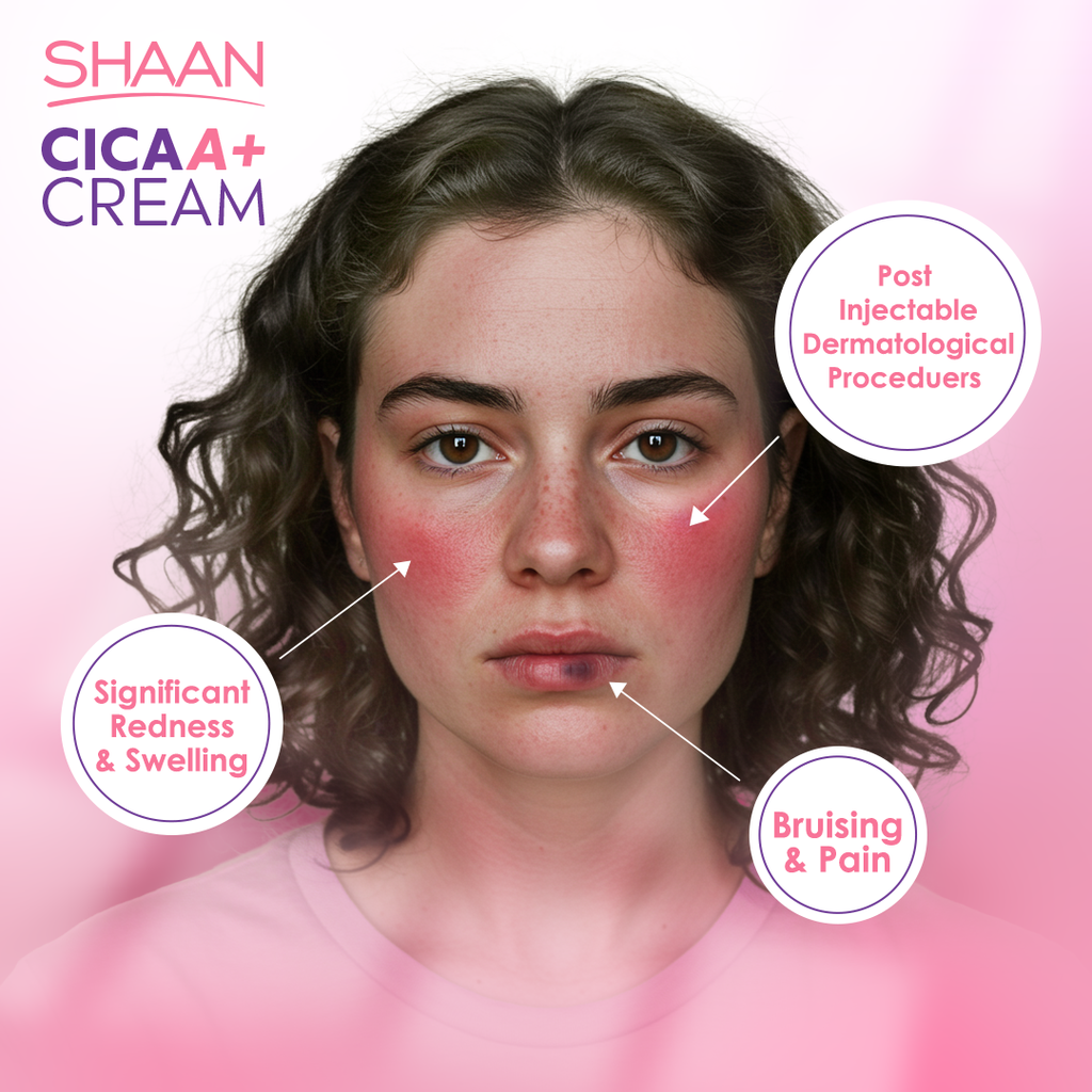 SHAAN CICA ARNICA+ CREAM 40 GM