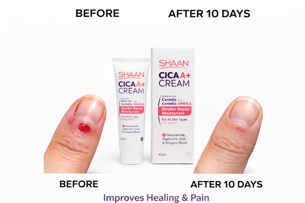 SHAAN CICA ARNICA+ CREAM 40 GM