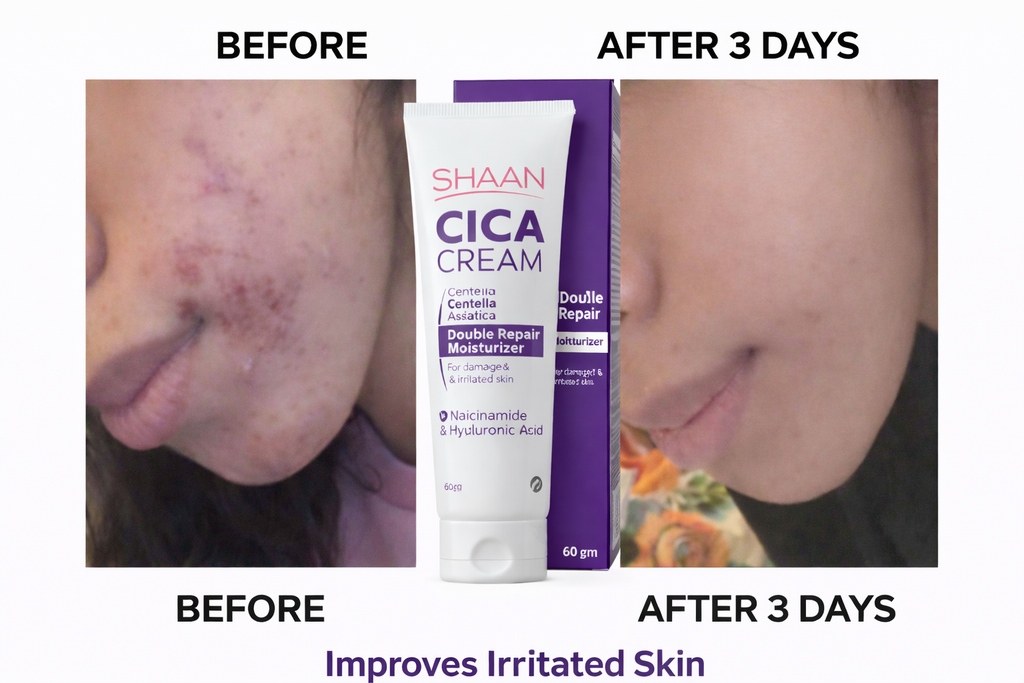 SHAAN CICA CREAM 60 GM