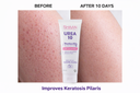 SHAAN UREA CREAM 200GM 