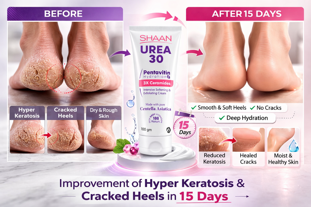 SHAAN UREA 30% BODY CREAM 100GM