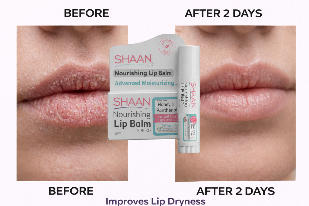 SHAAN LIP BALM CHERRY 5 GM